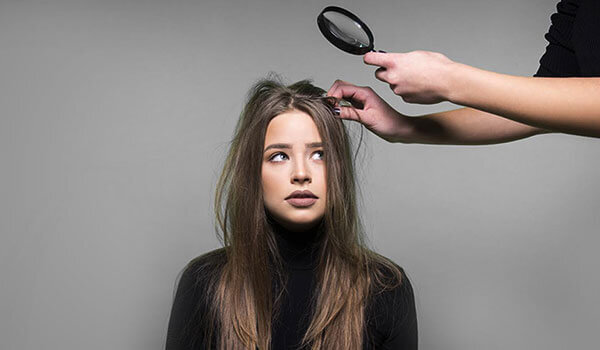 5 Hidden Reasons You’re Suffering From Dandruff