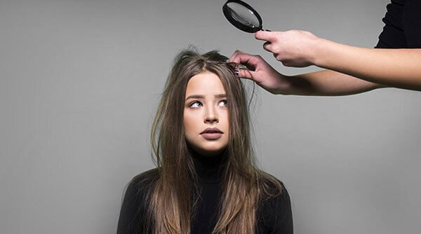 5 Hidden Reasons You’re Suffering From Dandruff