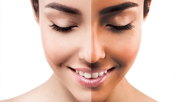How To Remove Tan Effectively—The Natural Way!