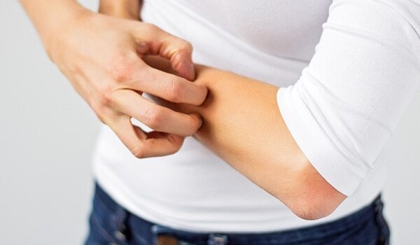 Common Summer Skin Infections And How To Treat Them