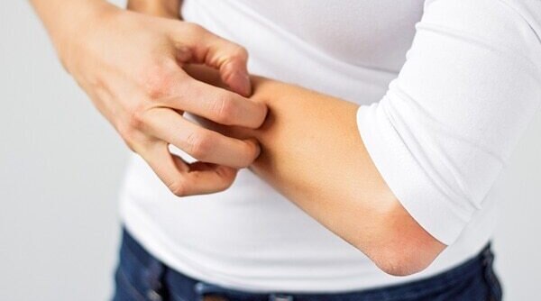 Common Summer Skin Infections And How To Treat Them