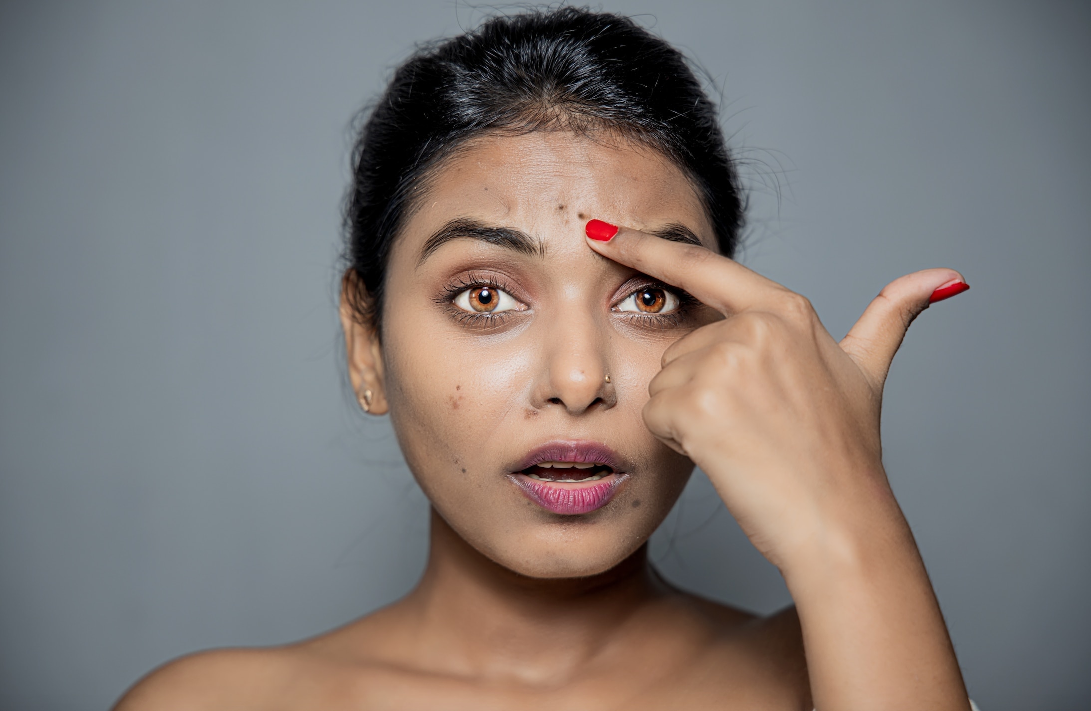 Remove Dark Spots Caused By Pimples: A Step-By-Step Guide