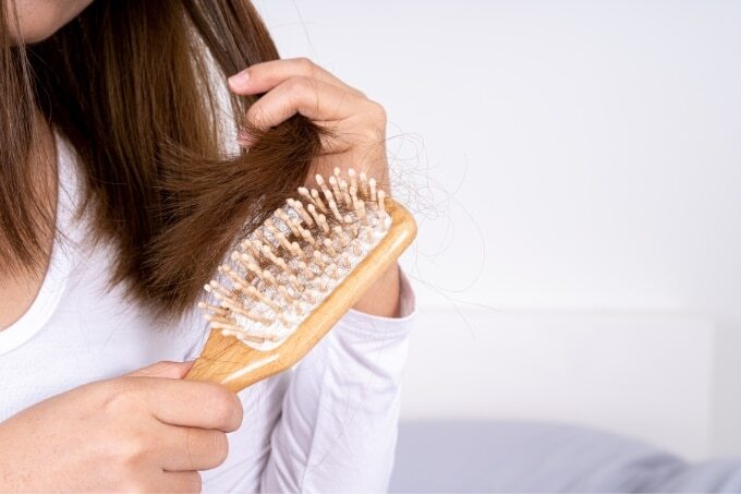 How To Avoid Hair Loss From Dandruff