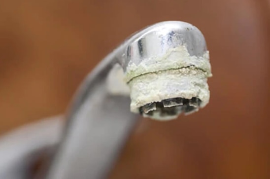 FAQs about effects of hard water on skin