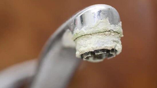 FAQs about effects of hard water on skin