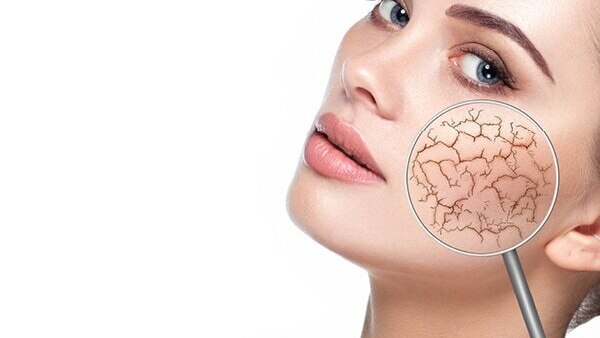 FAQs about effects of hard water on skin