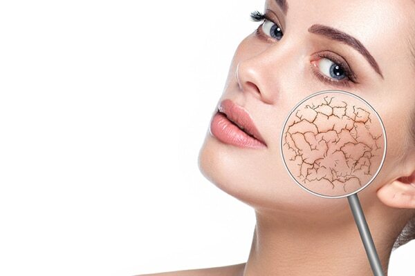 FAQs about effects of hard water on skin