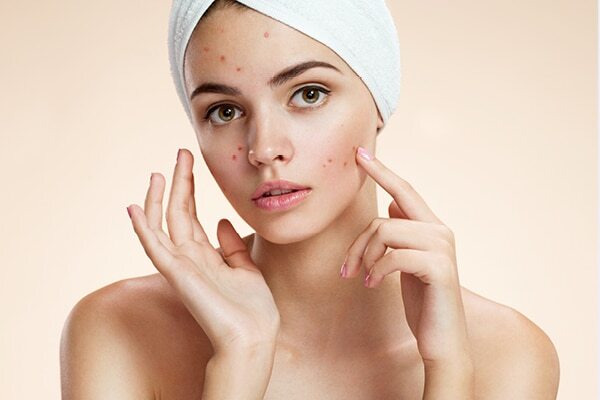 FAQs about effects of hard water on skin