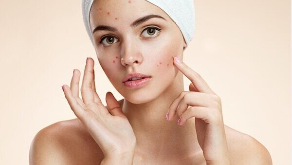 FAQs about effects of hard water on skin