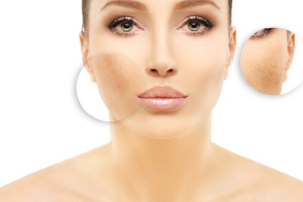 FAQs about effects of hard water on skin