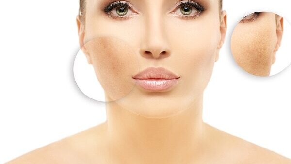 FAQs about effects of hard water on skin