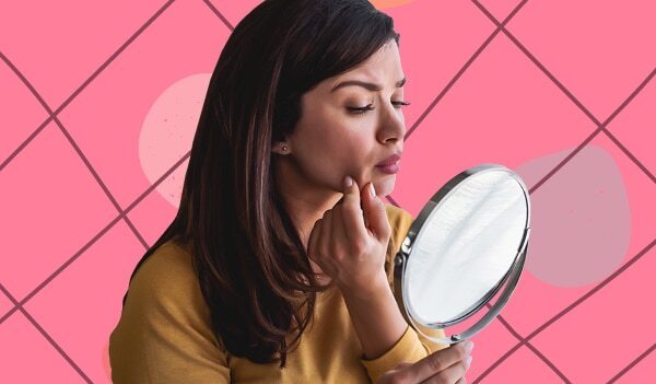 Comedonal Acne - An Expert’s Guide On What It Is And Its Causes