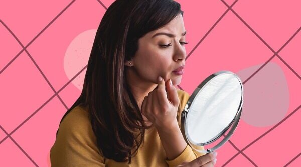 Comedonal Acne - An Expert’s Guide On What It Is And Its Causes