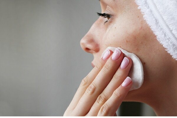 FAQs for comedonal acne