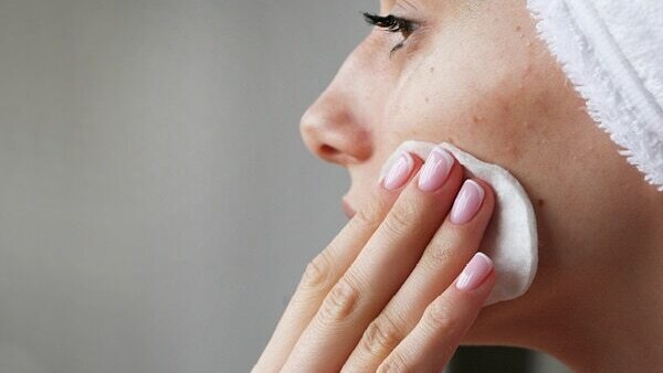 FAQs for comedonal acne