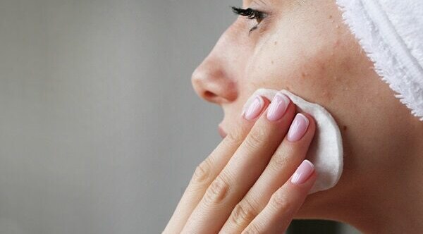 FAQs for comedonal acne