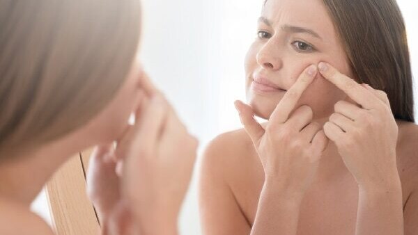 FAQs for comedonal acne