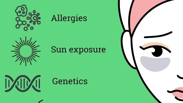 FAQs on eye puffiness