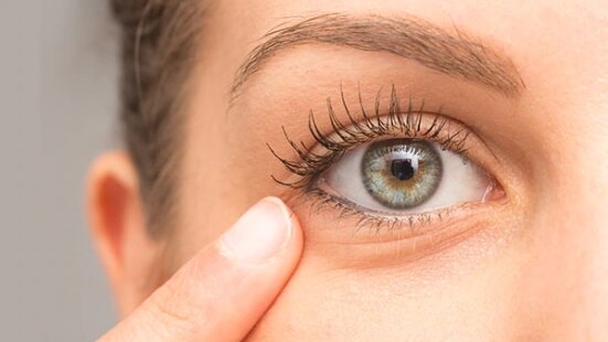 FAQs on eye puffiness