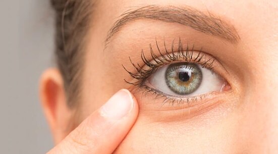 FAQs on eye puffiness