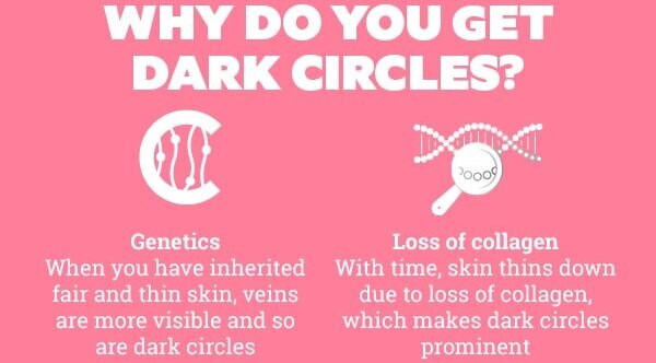 What is the proper diet when treating dark circles?