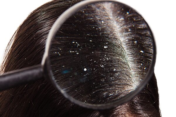 smelly hair causes