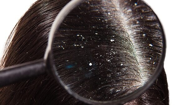 smelly hair causes