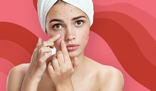 Triangle Of Death: An Area Where You Should Never Ever Pop A Pimple