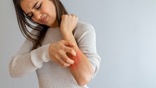 FAQs about fish oil benefits