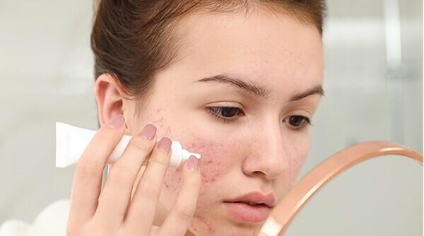 5 Things To Keep In Mind when Using Spot Treatments