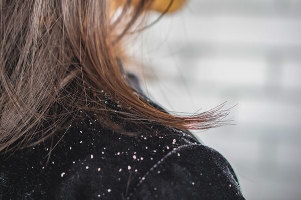 FAQs on types of hair spas