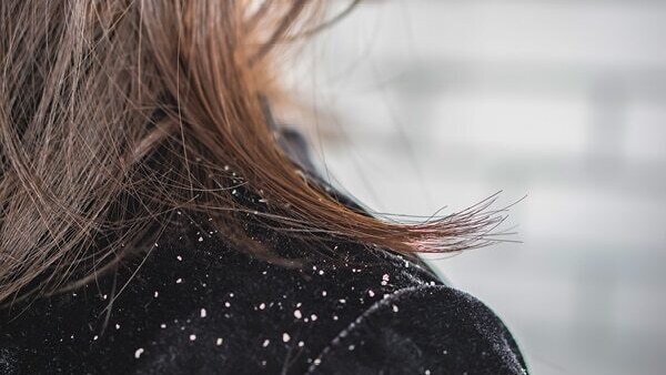 FAQs on types of hair spas
