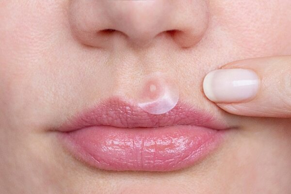 Spot treatment