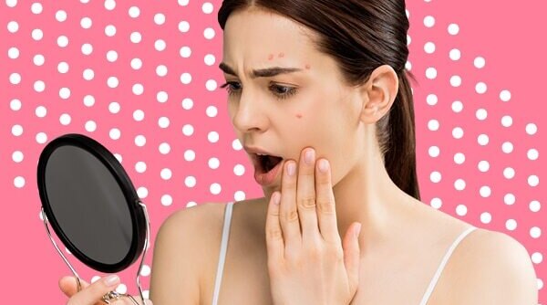 What Is Hormonal Acne And What Is The Best Way To Deal With It?