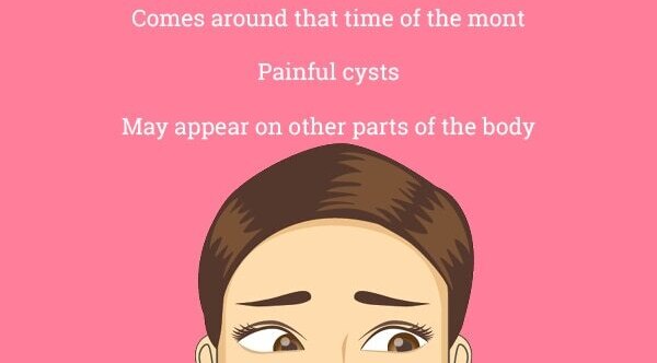 FAQs about hormonal acne