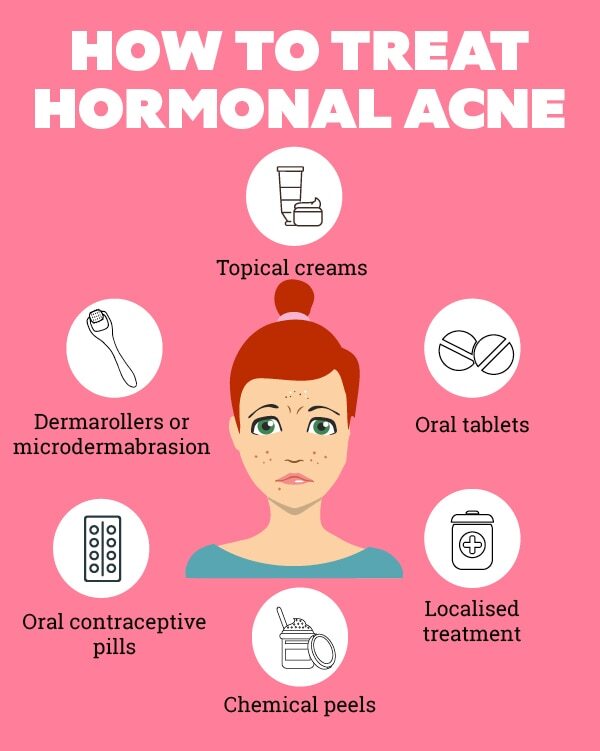 FAQs about hormonal acne