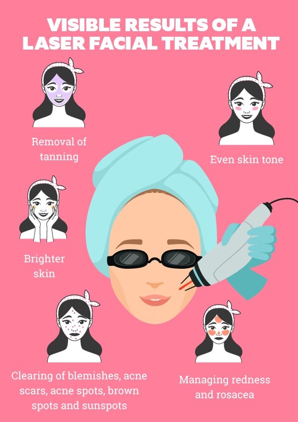 FAQs about laser facial treatment