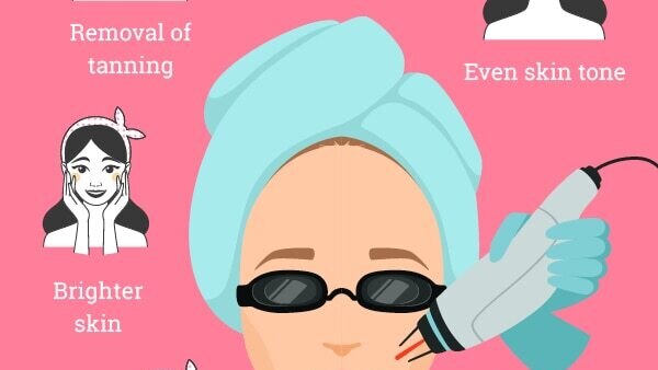 FAQs about laser facial treatment
