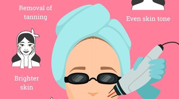 FAQs about laser facial treatment