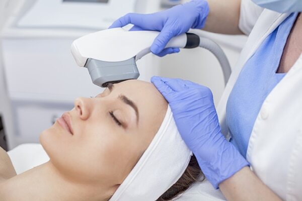 FAQs about laser facial treatment
