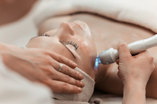 FAQs about laser facial treatment