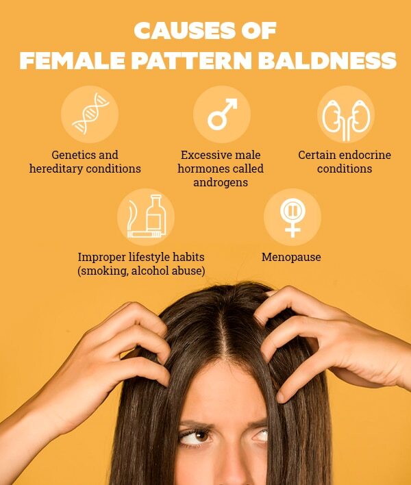 FAQs about female pattern baldness