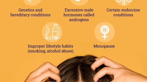 FAQs about female pattern baldness