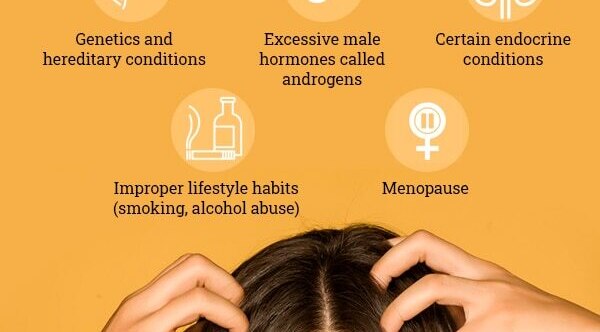 FAQs about female pattern baldness