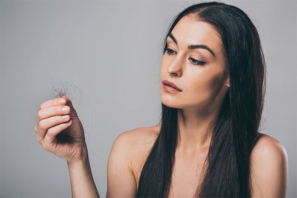 FAQs about female pattern baldness