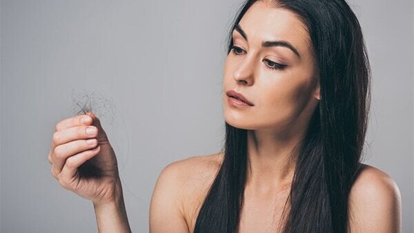 FAQs about female pattern baldness