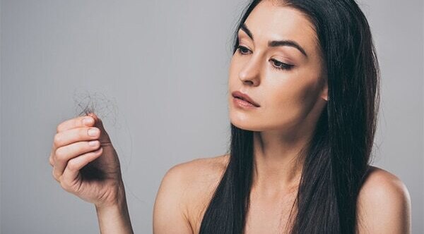 FAQs about female pattern baldness