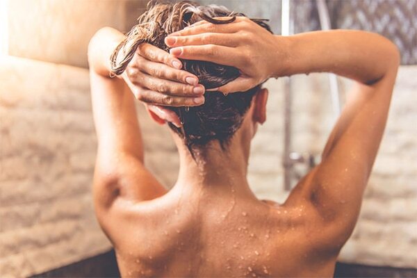 FAQs about female pattern baldness