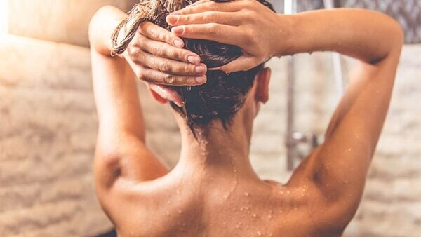 FAQs about female pattern baldness
