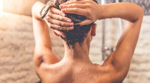 FAQs about female pattern baldness